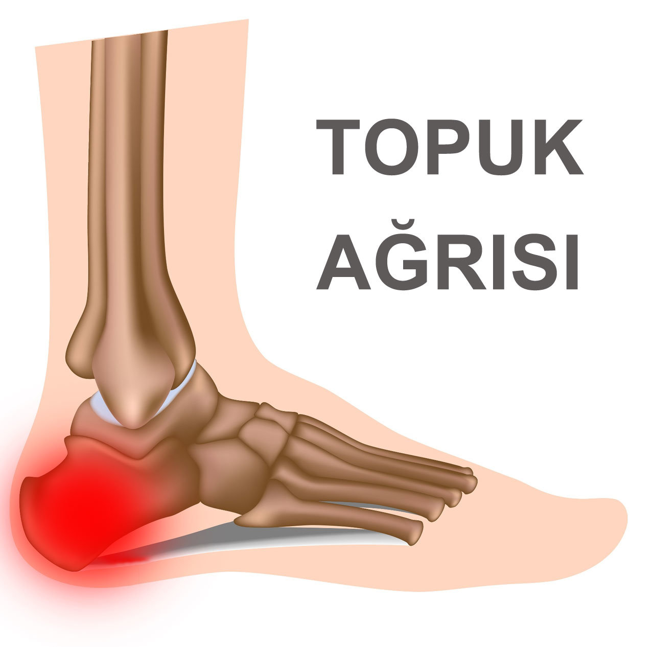 Topuk Ağrısı